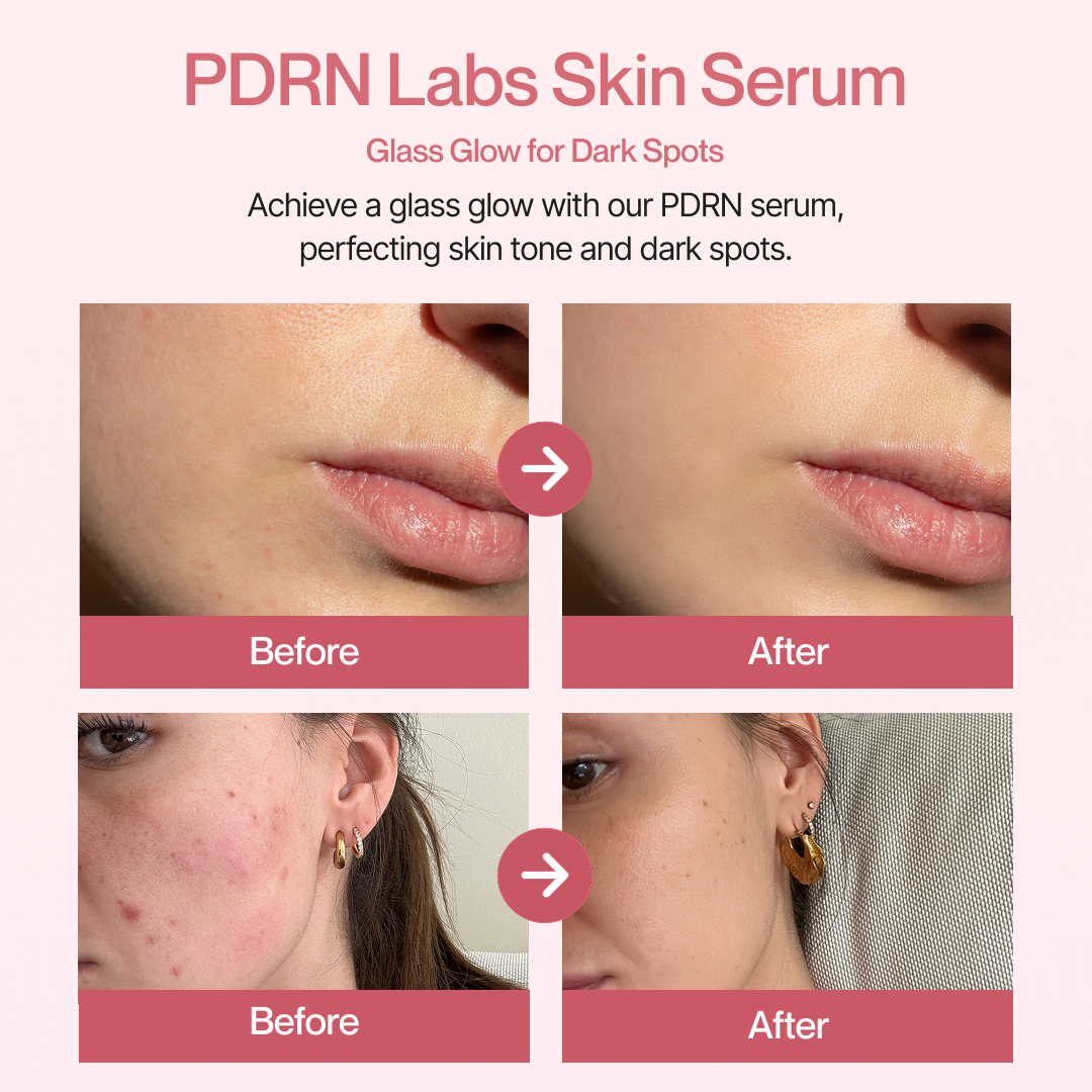 PDRN Complete 5-Step Glass Skin System